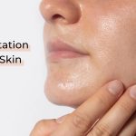 Most Common Types of Skin Pigmentation Issues in Women